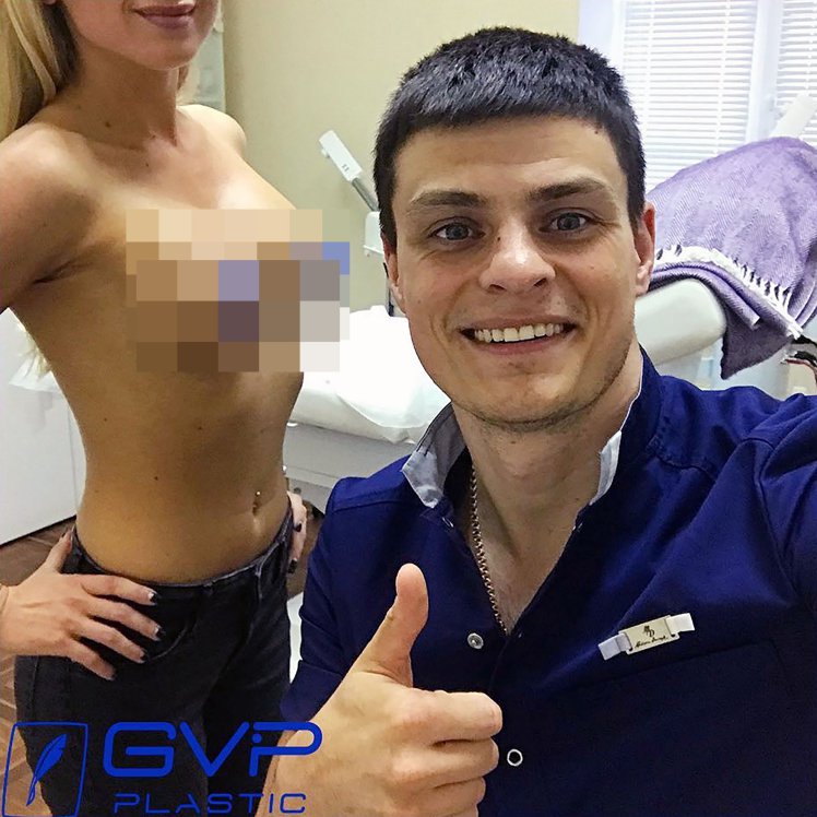 Patient dies as plastic surgeon takes selfie with her bare breasts