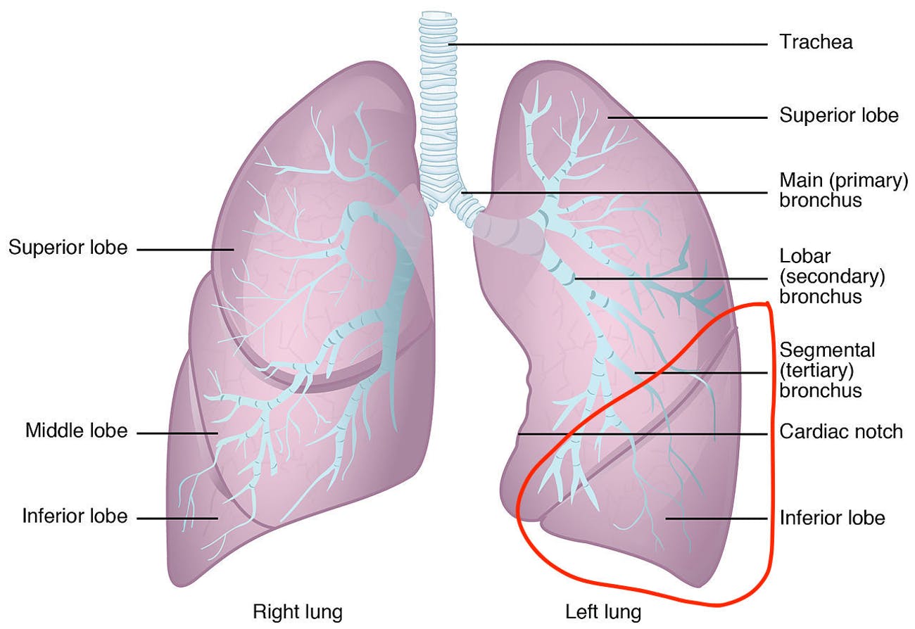 Lung Lobectomy: What you need to know