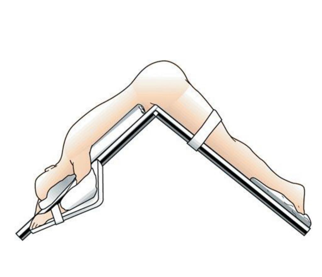 Kraske or Jackknife position