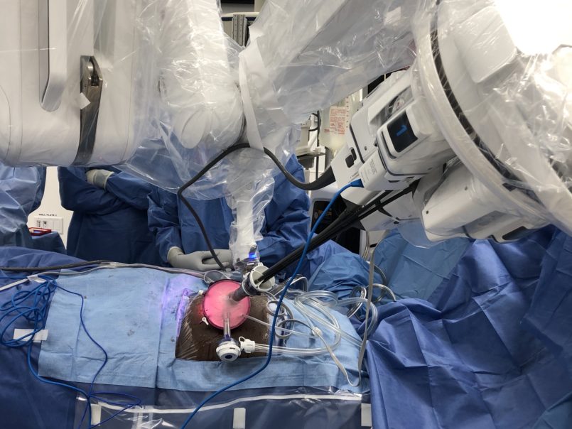 Cleveland Clinic First in the World to Perform Robotic Single-Port Kidney Transplant
