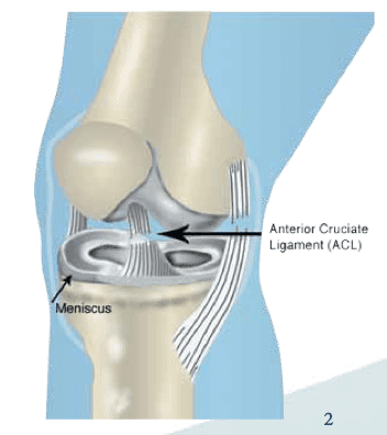 An ACL Tear Can Affect Your Brain in Addition to Your Knee