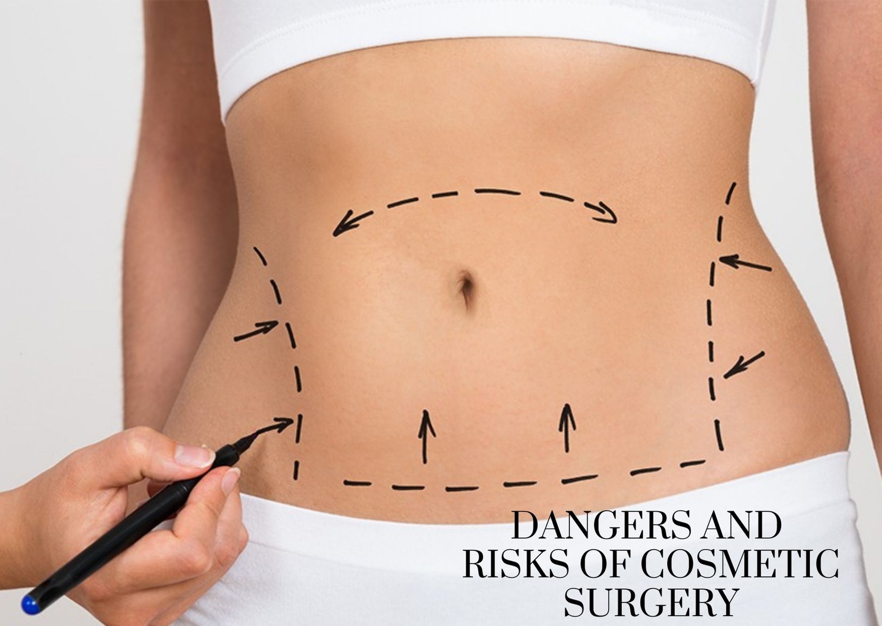 The Risks of Cosmetic Surgery: Here’s what you need to know!