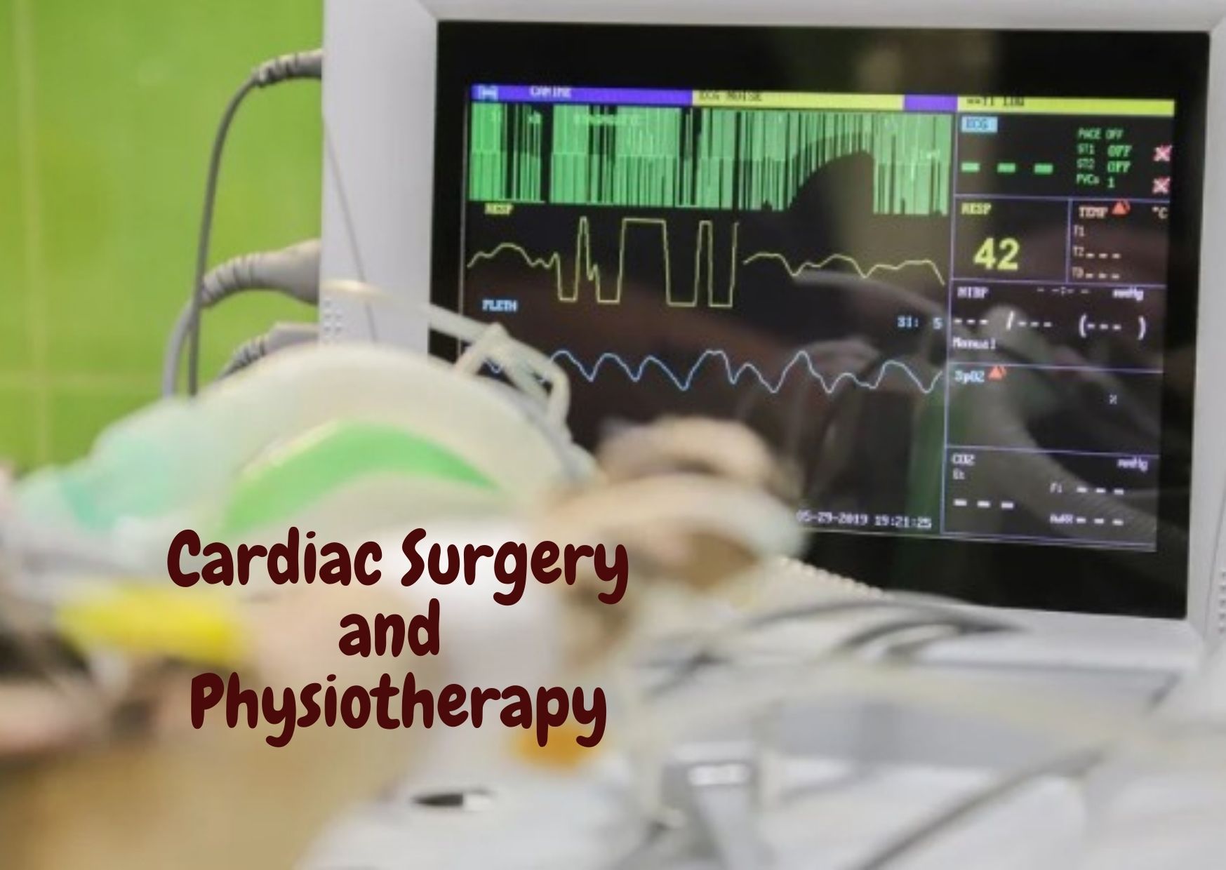 Rehabilitation after Cardiac Surgery using Physiotherapy