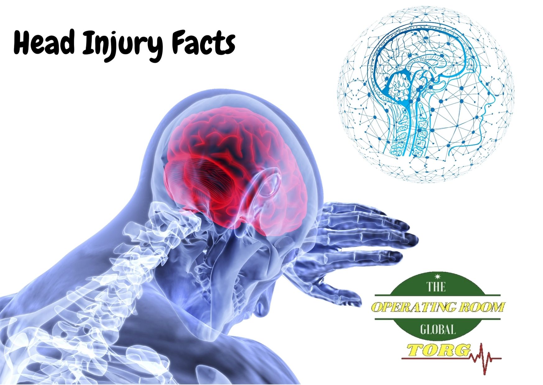 Head Injury Facts