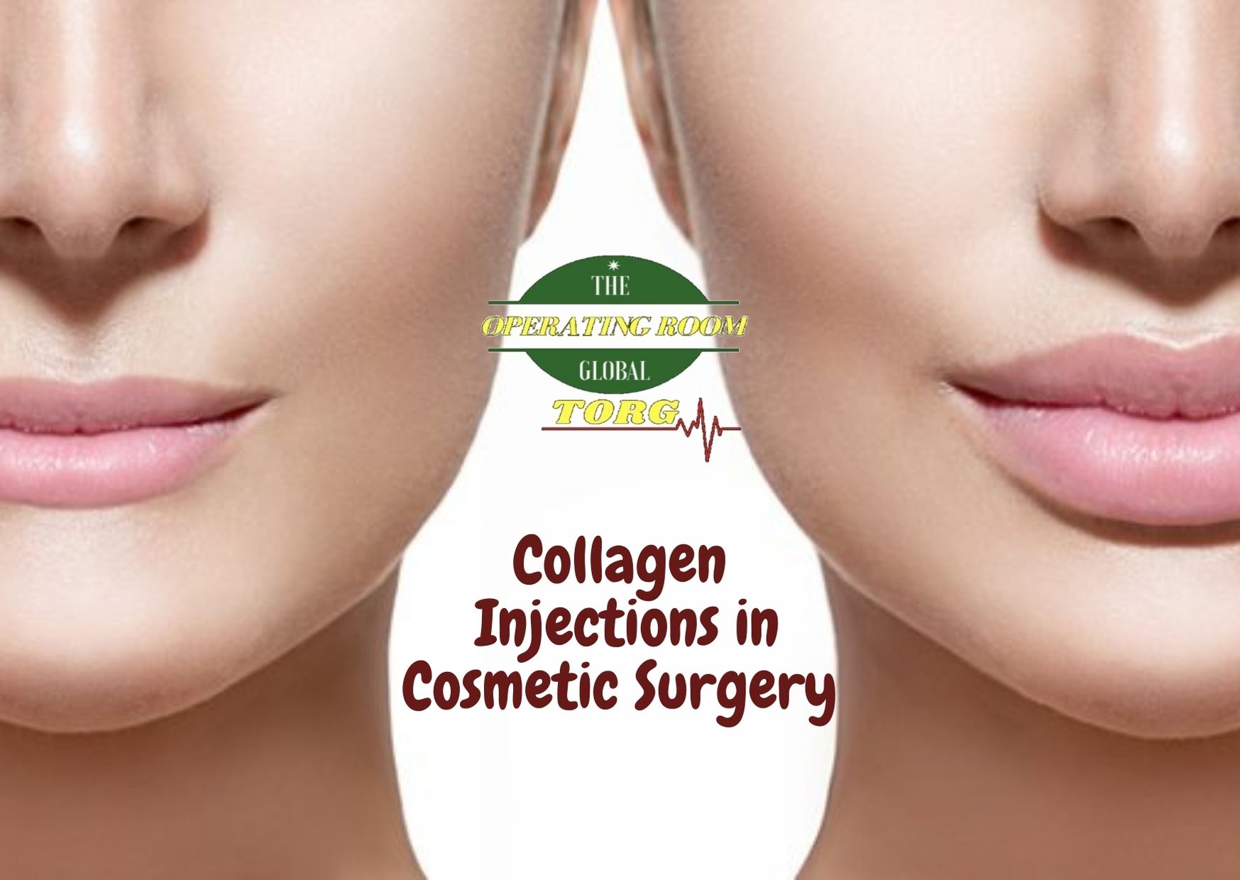 Collagen injections on the forefront of cosmetic plastic surgery