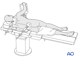 Lateral decubitus position