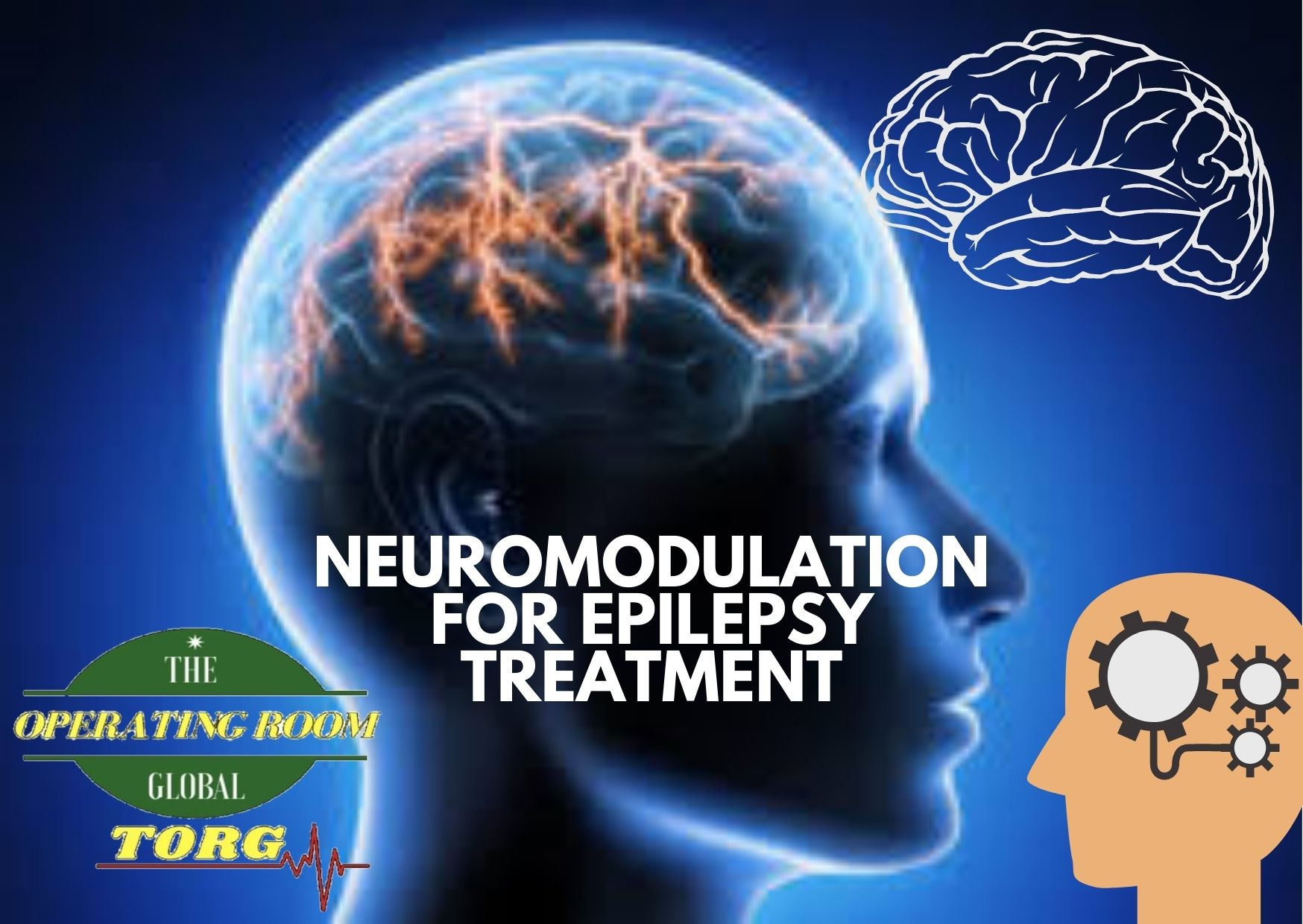 Neuromodulation for the Treatment of Epilepsy