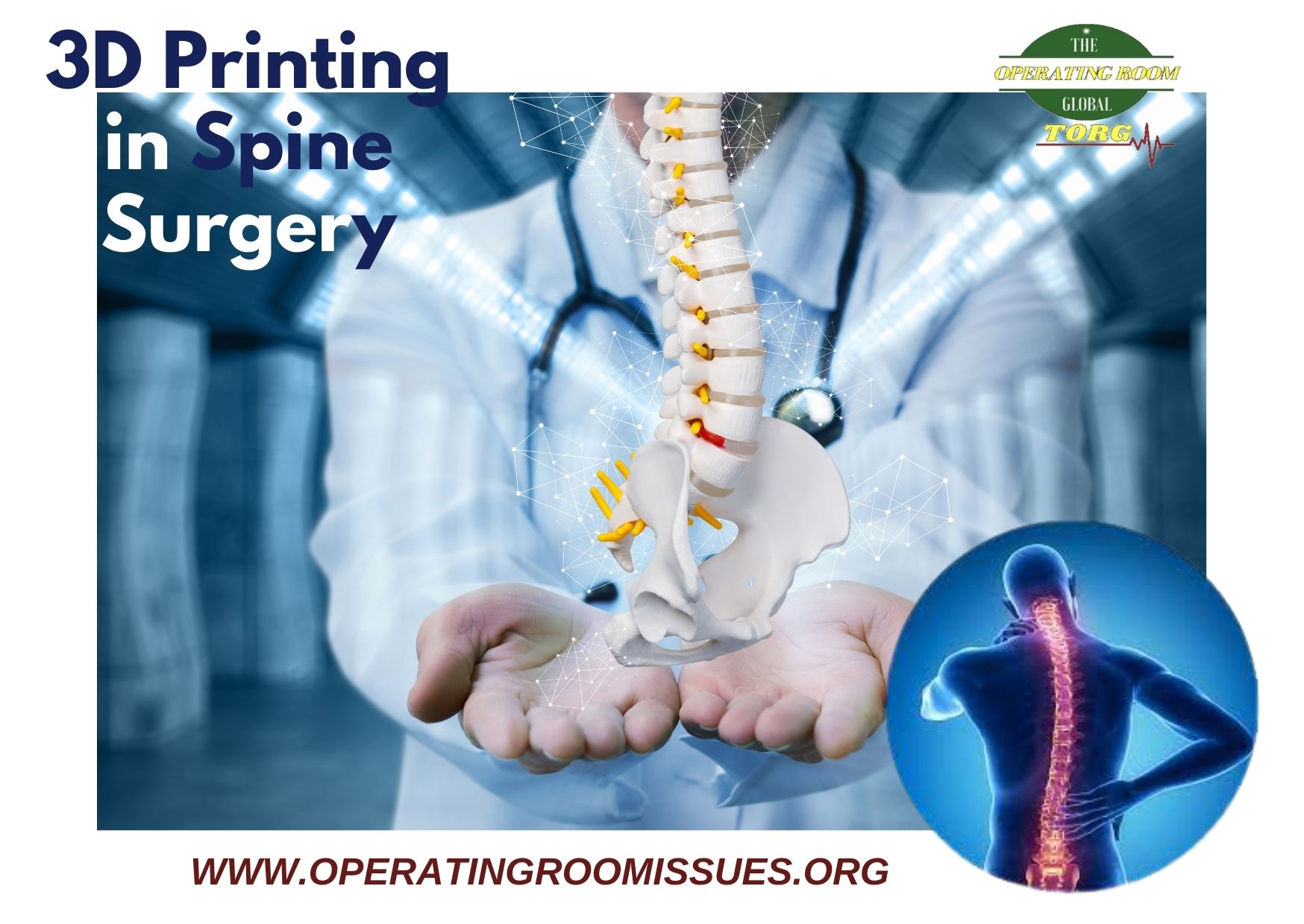 3D Printing in Spine Surgery – The prediction of surgeons