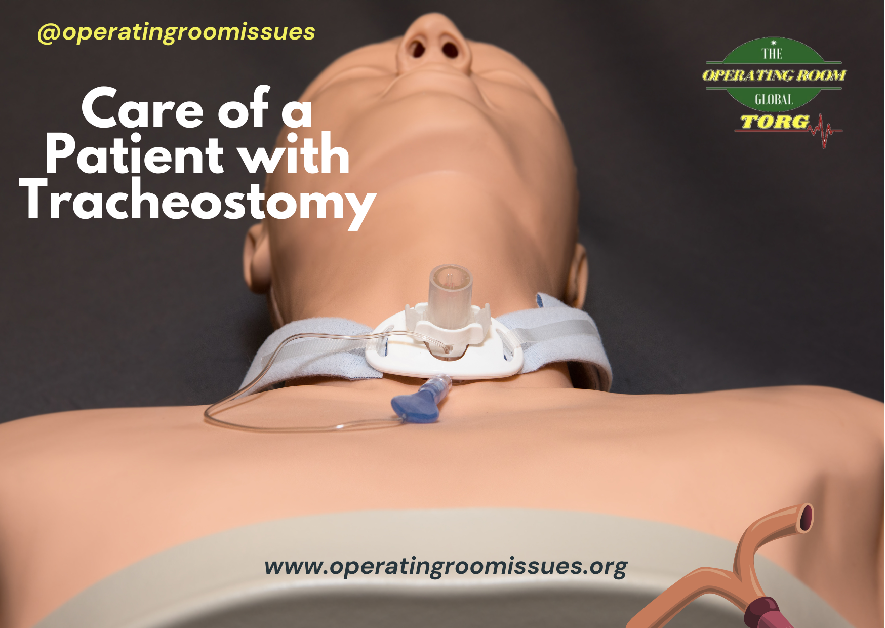 Nursing Care of a Patient with Tracheostomy