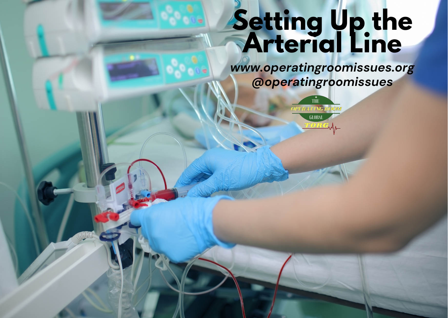 How to Set Up an Arterial Line – Detailed Explanation