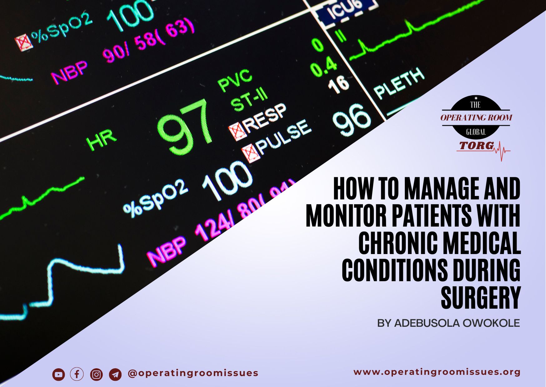 <strong>How to manage and monitor patients with chronic medical conditions during surgery</strong>
